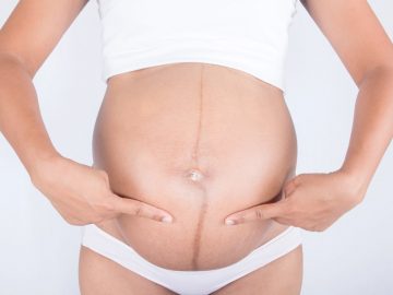 Hamilelikte Olusan Gobek Cizgisi Nedir