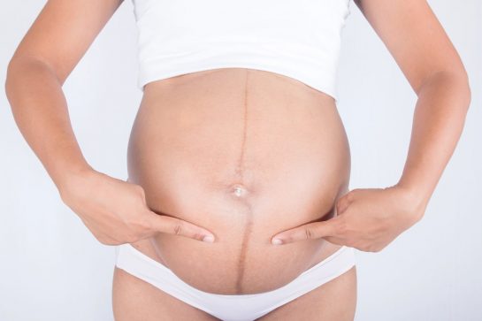 Hamilelikte Olusan Gobek Cizgisi Nedir