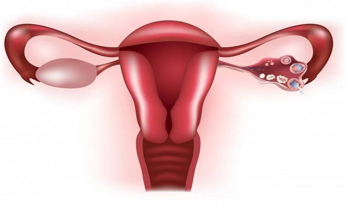 Endometriozis belirtileri